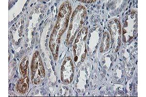 Immunohistochemical staining of paraffin-embedded Human Kidney tissue using anti-CCM2 mouse monoclonal antibody. (CCM2 抗体)
