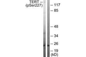 Western Blotting (WB) image for anti-Telomerase Reverse Transcriptase (TERT) (AA 196-245), (pSer227) antibody (ABIN482341) (TERT 抗体  (pSer227))
