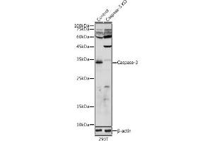 Western blot analysis of extracts from normal (control) and Caspase-3 knockout (KO) 293T cells, using Caspase-3 antibody (ABIN6131582, ABIN6137962, ABIN6137964 and ABIN6215049) at 1:1000 dilution. (Caspase 3 抗体  (AA 55-160))