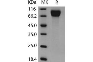Western Blotting (WB) image for Colony Stimulating Factor 1 Receptor (CSF1R) (Active) protein (His tag) (ABIN7320415) (CSF1R Protein (His tag))