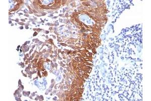 IHC testing of human skin stained with Cytokeratin 17 antibody (E3). (KRT17 抗体)