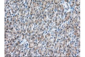 Immunohistochemical staining of paraffin-embedded Human colon tissue using anti-USP5 mouse monoclonal antibody. (USP5 抗体)