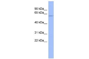 WB Suggested Anti-TPTE Antibody Titration:  0. (TPTE 抗体  (Middle Region))