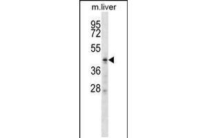 Western blot analysis in mouse liver tissue lysates (35ug/lane). (ZDHHC6 抗体  (C-Term))