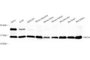 Western blot analysis of UBE2A (ABIN7075356) at dilution of 1: 500 (Rad6 抗体)