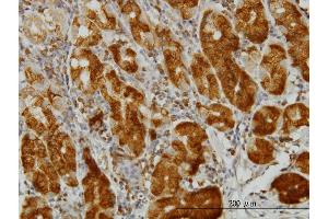 Immunostaining (ISt) image for anti-Enolase 3 (Beta, Muscle) (ENO3) (AA 228-277) antibody (ABIN560744)