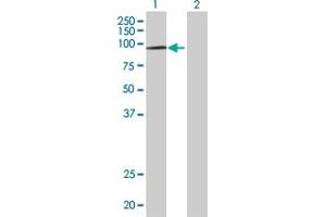 Western Blotting (WB) image for HIRA 293T Cell Transient Overexpression Lysate(Denatured) (ABIN1333818)