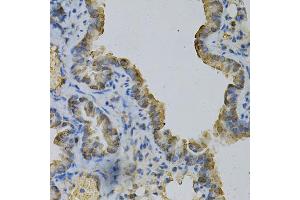 Immunohistochemistry of paraffin-embedded mouse lung using GLUL Antibody (ABIN5973158) at dilution of 1/100 (40x lens). (GLUL 抗体)