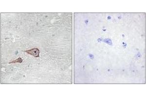 Immunohistochemistry (IHC) image for anti-P-Cadherin (CDH3) (AA 51-100) antibody (ABIN2889885) (P-Cadherin 抗体  (AA 51-100))