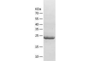 14-3-3 theta Protein (YWHAQ) (AA 1-245) (His tag)