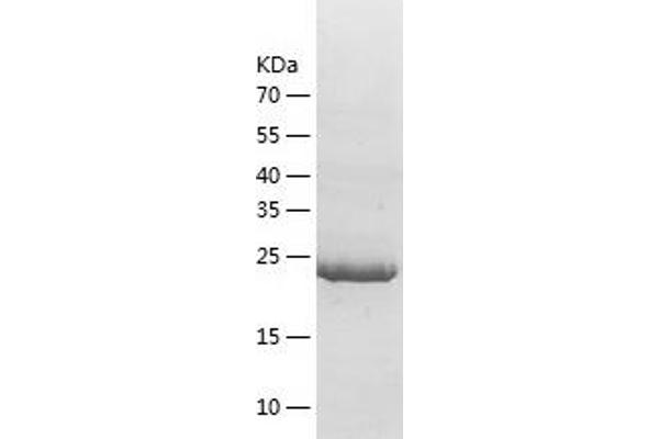 14-3-3 theta Protein (YWHAQ) (AA 1-245) (His tag)