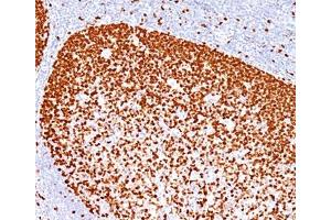 IHC testing of human human tonsil stained with PCNA antibody (PC10). (PCNA 抗体)