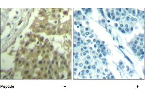 Image no. 1 for anti-Cyclin-Dependent Kinase 1 (CDK1) (Tyr19) antibody (ABIN319406) (CDK1 抗体  (Tyr19))
