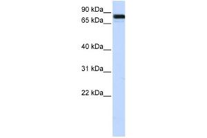 WB Suggested Anti-EWSR1 Antibody Titration:  0. (EWSR1 抗体  (Middle Region))