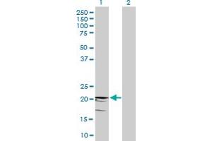 Western Blot analysis of CD3D expression in transfected 293T cell line by CD3D MaxPab polyclonal antibody. (CD3D 抗体  (AA 1-171))