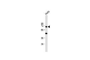 Anti-KRT10 Antibody (N-term) at 1:2000 dilution + Hela whole cell lysate Lysates/proteins at 20 μg per lane. (Keratin 10 抗体  (N-Term))