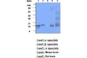 Western Blotting (WB) image for anti-Synuclein, alpha (SNCA) (AA 119-140) antibody (ABIN317562) (SNCA 抗体  (AA 119-140))