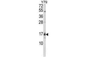 Western blot analysis of GADD45A Antibody (C-term) in Y79 cell line lysates (35ug/lane). (GADD45A 抗体  (C-Term))