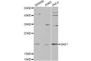 Western blot analysis of extracts of various cell lines, using SKP1 antibody. (SKP1 抗体)
