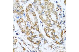 Immunohistochemistry of paraffin-embedded human gastric using ANTXR2 antibody at dilution of 1:100 (x40 lens). (ANTXR2 抗体)