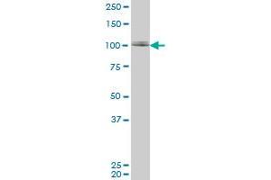 ZNF281 monoclonal antibody (M02), clone 1C9. (ZNF281 抗体  (AA 787-893))