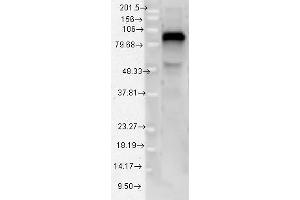 Western Blotting (WB) image for anti-Toll-Like Receptor 4 (TLR4) (Internal Region) antibody (ABIN6655892)