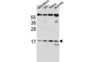 TCRB Antibody (Center) western blot analysis in MDA-MB231, 293, Ramos, NCI-H460 cell line lysates (35 µg/lane). (TCRb 抗体  (Middle Region))