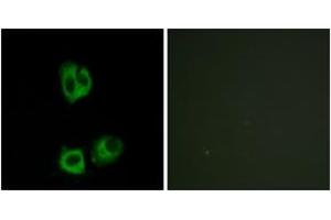 Immunofluorescence (IF) image for anti-Lymphocyte-Specific Protein tyrosine Kinase (LCK) (pTyr393) antibody (ABIN2888462) (LCK 抗体  (pTyr393))