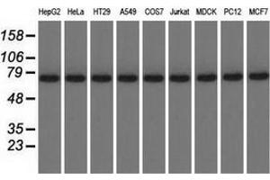 Western blot analysis of extracts (35 µg) from 9 different cell lines by using anti-KBTBD7 monoclonal antibody. (KBTBD7 抗体)