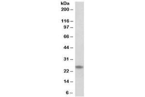 Western blot testing of human skeletal muscle lysate with TNNI1 antibody at 0. (TNNI1 抗体)