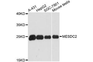 Western blot analysis of extracts of various cell lines, using MESDC2 antibody. (MESDC2 抗体)