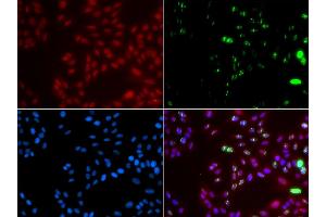 Immunofluorescence analysis of GFP-RNF168 transgenic U2OS cell using XPA antibody. (XPA 抗体)
