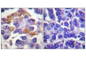 Immunohistochemical analysis of paraffin-embedded human pancreas tissue using Raf1 (Phospho-Tyr341) antibody (left)or the same antibody preincubated with blocking peptide (right). (RAF1 抗体  (pTyr341))