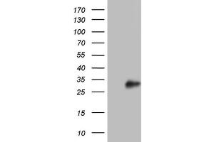 Western Blotting (WB) image for anti-Adiponectin (ADIPOQ) (AA 19-244) antibody (ABIN2715779) (ADIPOQ 抗体  (AA 19-244))