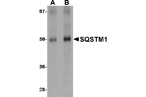Western blot analysis of SQSTM1 in Human spleen tissue lysate with SQSTM1 antibody at (A) 1 and (B) 2 µg/mL. (SQSTM1 抗体  (C-Term))