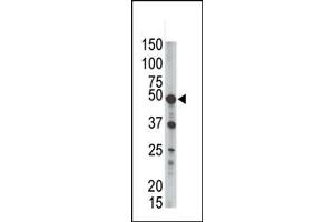 Western Blotting (WB) image for anti-GPI-anchor transamidase (GPI8) (C-Term) antibody (ABIN357726) (PIGK 抗体  (C-Term))