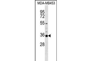 KCNA5 Antibody (C-term) (ABIN1537420 and ABIN2848693) western blot analysis in MDA-M cell line lysates (35 μg/lane). (KCNA5 抗体  (C-Term))