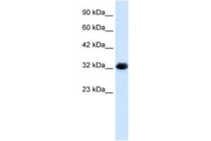Western Blotting (WB) image for anti-Chromosome 22 Open Reading Frame 31 (C22orf31) antibody (ABIN2461056) (C22orf31 抗体)