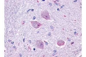 Immunohistochemical staining of Brain (Neurons and glia) using anti- CHRM4 antibody ABIN122327 (CHRM4 抗体)