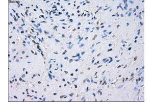 Immunohistochemical staining of paraffin-embedded prostate tissue using anti-FCGR2A mouse monoclonal antibody. (FCGR2A 抗体)