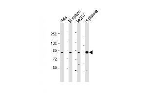 All lanes : Anti-GSN Antibody (C-term) at 1:1000-1:2000 dilution Lane 1: Hela whole cell lysates Lane 2: mouse spleen lysates Lane 3: MCF-7 whole cell lysates Lane 4: human plasma lysates Lysates/proteins at 20 μg per lane. (Gelsolin 抗体  (C-Term))