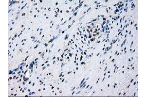 Immunohistochemical staining of paraffin-embedded liver tissue using anti-ID3mouse monoclonal antibody. (ID3 抗体)