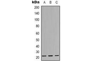 Western blot analysis of CBFB expression in Jurkat (A), HUVEC (B), K562 (C) whole cell lysates. (CBFB 抗体  (N-Term))
