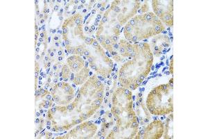 Immunohistochemistry of paraffin-embedded mouse kidney using HDAC6 antibody (ABIN5970867) at dilution of 1/100 (40x lens). (HDAC6 抗体)