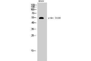 Western Blotting (WB) image for anti-V-Akt Murine Thymoma Viral Oncogene Homolog 1 (AKT1) (pSer124) antibody (ABIN6284601) (AKT1 抗体  (pSer124))