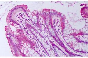 Anti-BMP2 antibody IHC staining of human colon, epithelium. (BMP2 抗体)