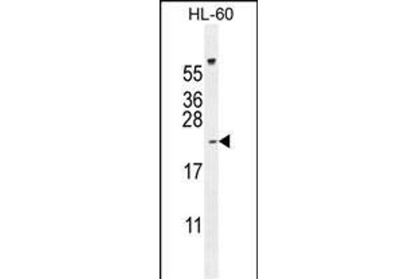 PLA2G2C 抗体  (C-Term)