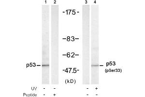 Image no. 1 for anti-Tumor Protein P53 (TP53) (pSer33) antibody (ABIN319215) (p53 抗体  (pSer33))