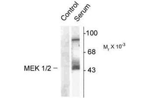 Image no. 1 for anti-Mitogen-Activated Protein Kinase Kinase 1 (MAP2K1) (pSer218), (Ser222) antibody (ABIN221121) (MEK1 抗体  (pSer218, Ser222))