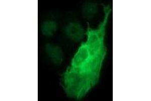 Image no. 2 for anti-Tyrosine Hydroxylase (TH) antibody (ABIN1501367) (Tyrosine Hydroxylase 抗体)